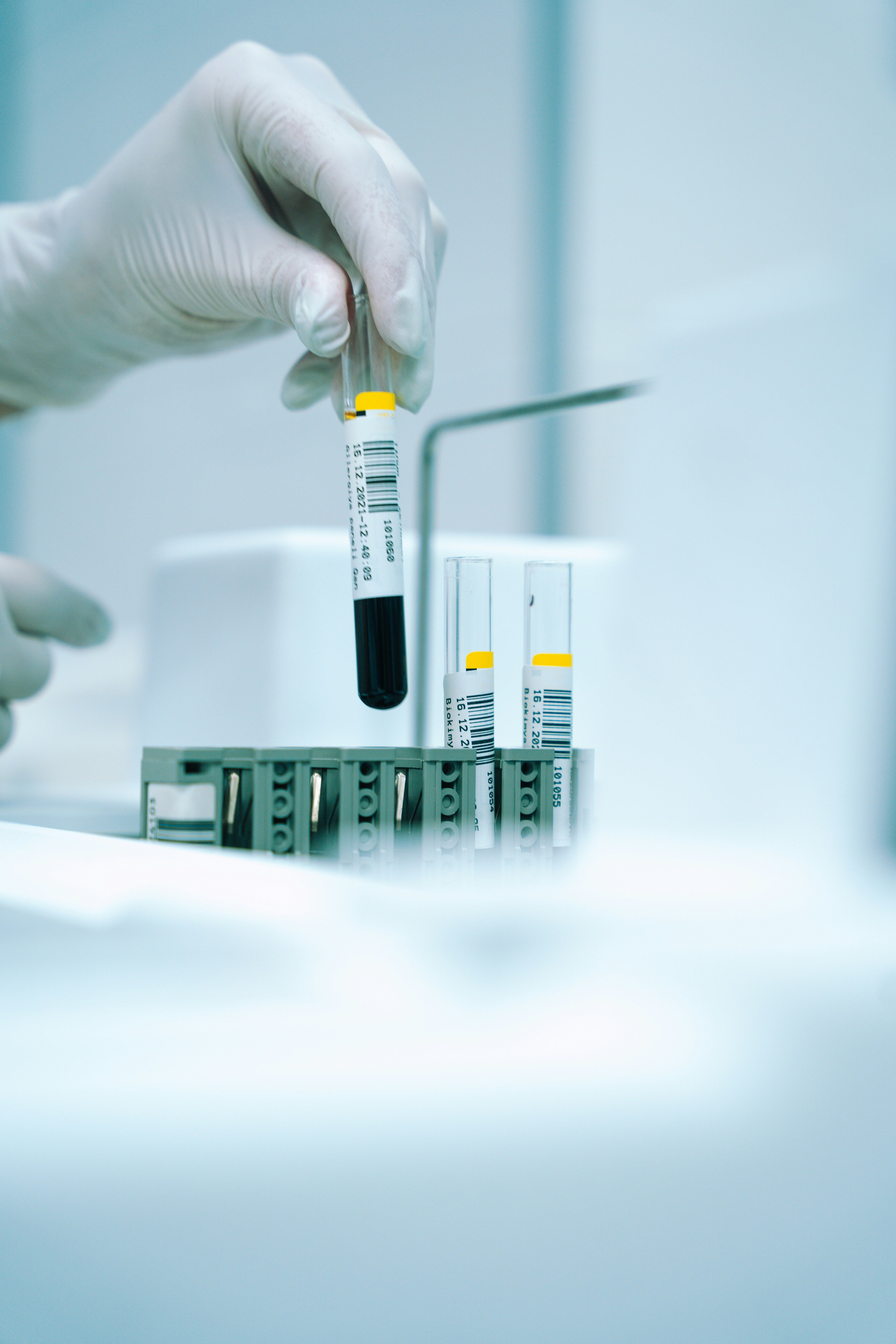 Preconception Genetic Testing: What Every Couple Should Know