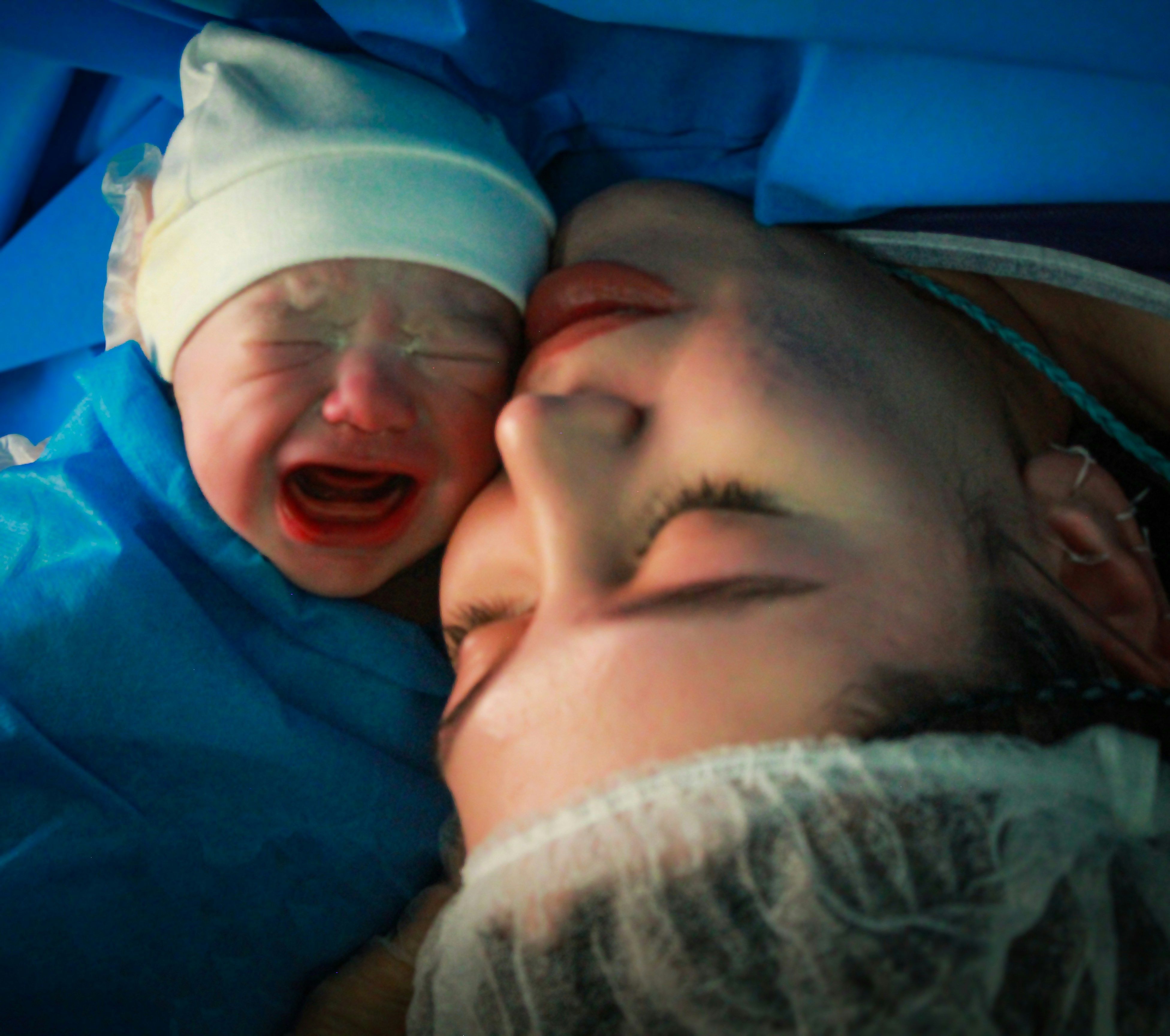 C-Section: What to Expect Before, During, and After